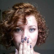 Foto de Projeto 2 Coelhos