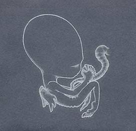 Agaetis Byrjun - 2000 • Álbum