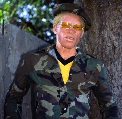 Foto de Yellowman