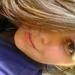 LisS