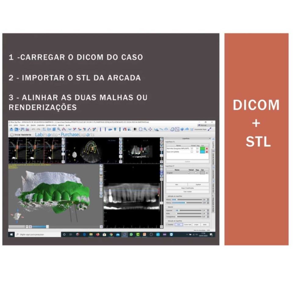 O que são os arquivos DICOM e STL e qual a utilidade para o planejamento digital em Odontologia
