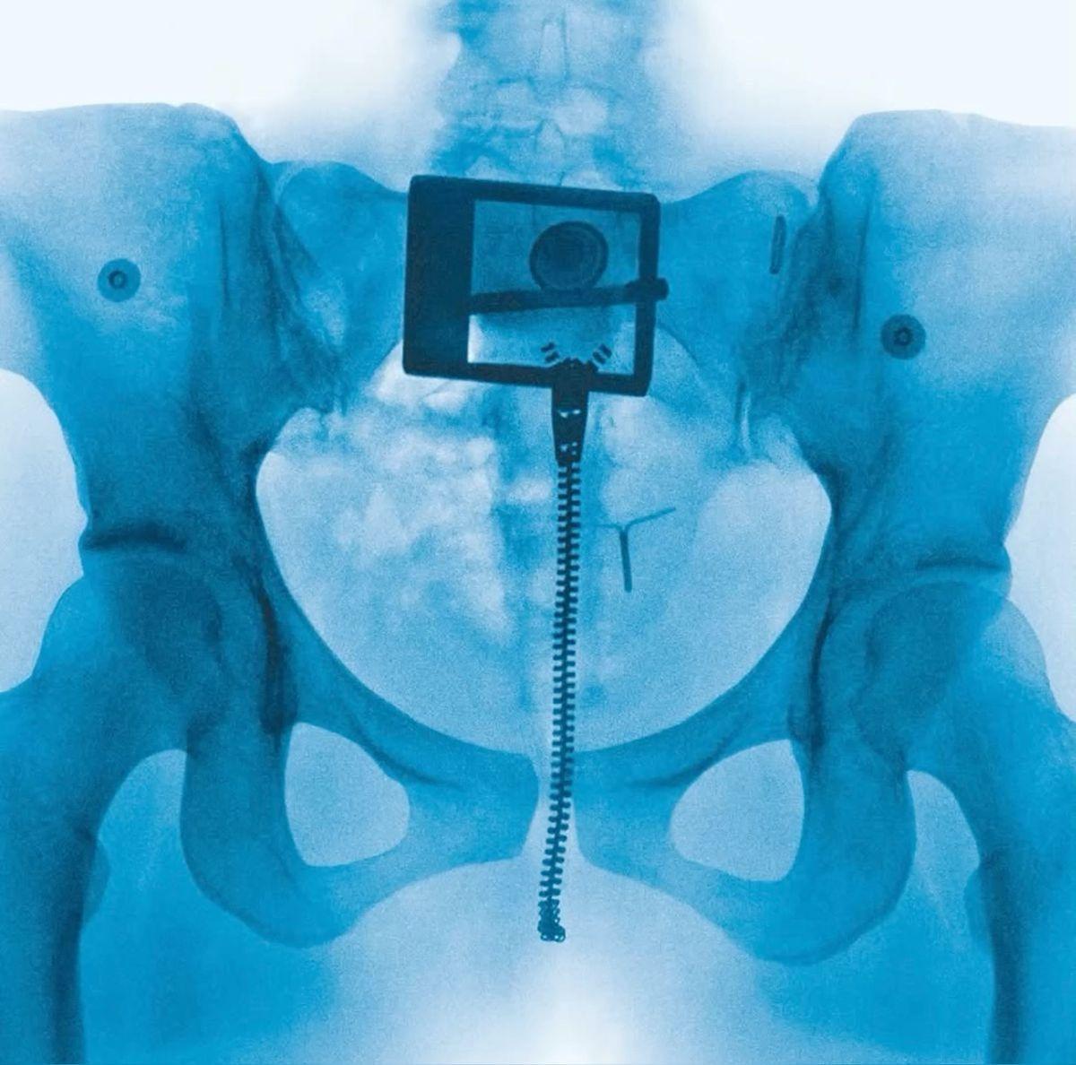 Portada de Sencillo/EP "Hammer", de Lorde