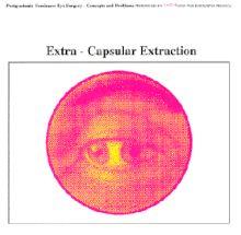 Capa do Single/EP "Extra-Capsular Extraction", de Earth