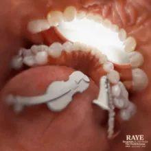 Capa do álbum "Escapism. (feat. 070 Shake)", de RAYE