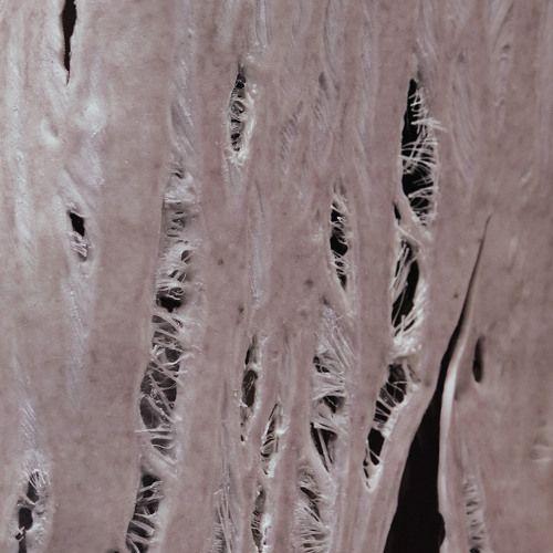 Capa do álbum "Torn", de COBRAH