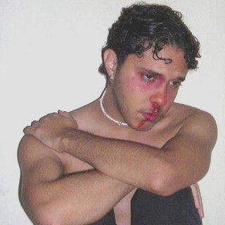 Portada de Álbum "Isso Me Machuca Tanto", de K4YO