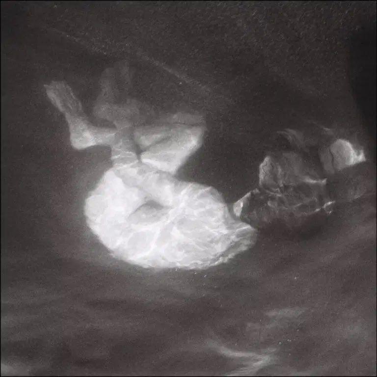 Portada de Álbum "Glow", de Alice Phoebe Lou