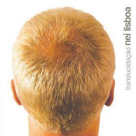 Portada de Álbum "Translucidação", de Nei Lisboa