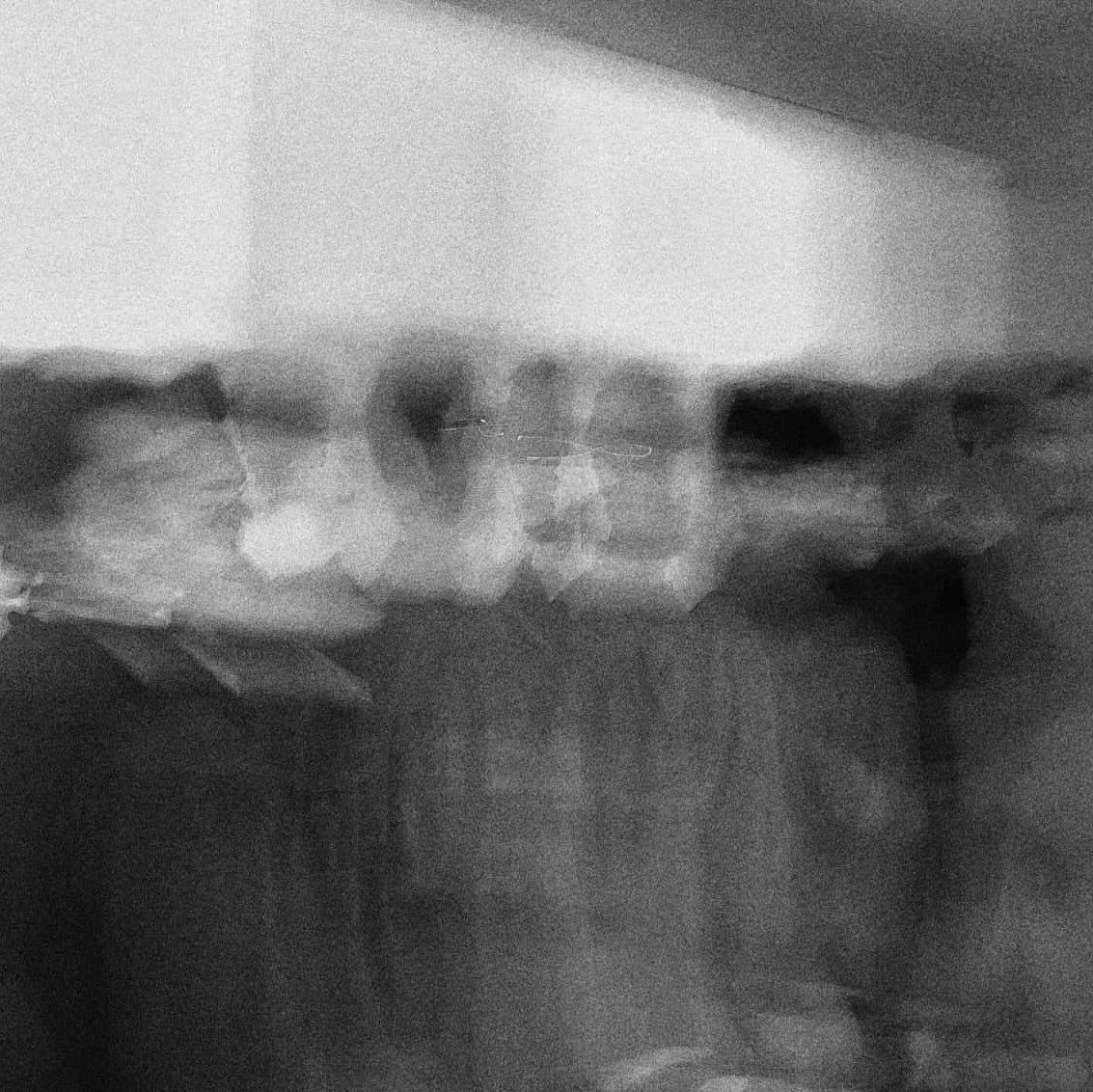 Portada de Sencillo/EP "Old Story", de Television Recorder