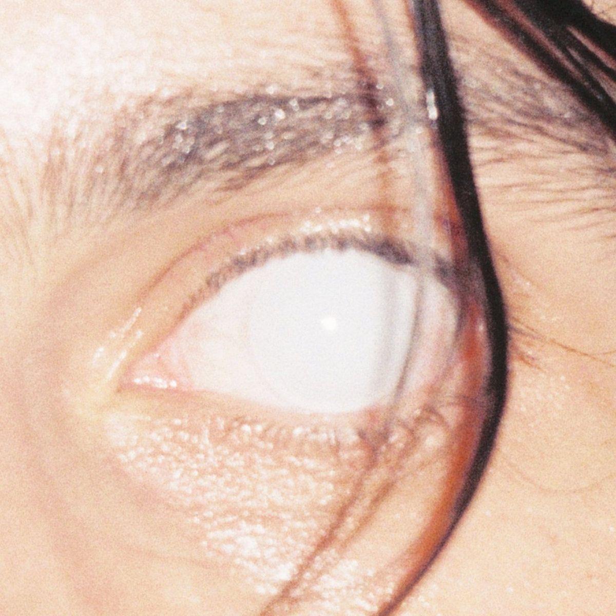 Portada de Álbum "Trust", de Armlock