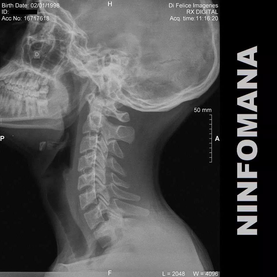 Portada de Sencillo/EP "Mega", de Ninfomana