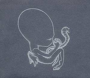 Portada de Álbum "Agaetis Byrjun", de Sigur Rós