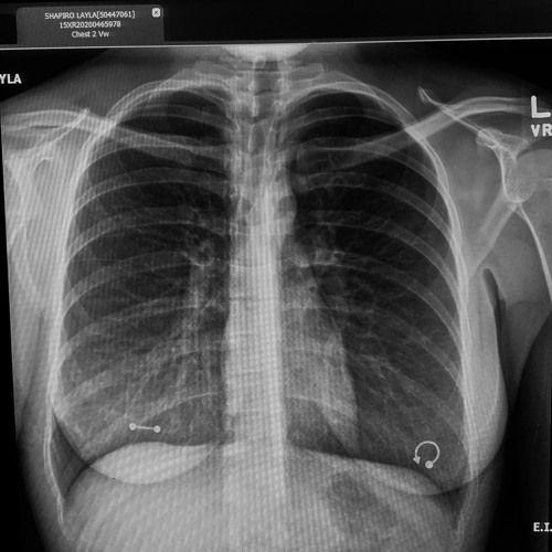 Capa do Single/EP "Demo", de Toopoor