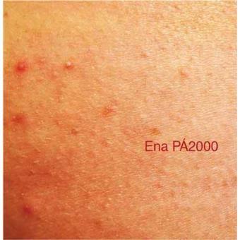 Capa do Álbum "O Álbum Bronco", de Ena Pá 2000