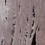 Torn}