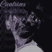 Cicatrizes