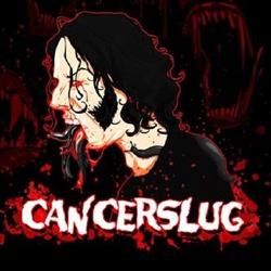 Foto de Cancerslug